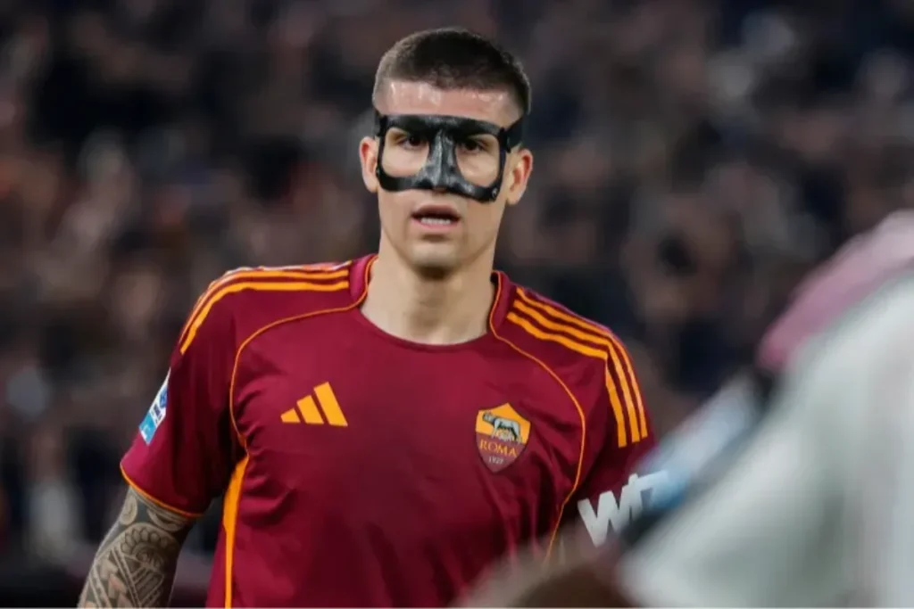Giocatore della Roma con maschera protettiva nera durante una partita, indossa la maglia giallorossa Adidas con logo del club